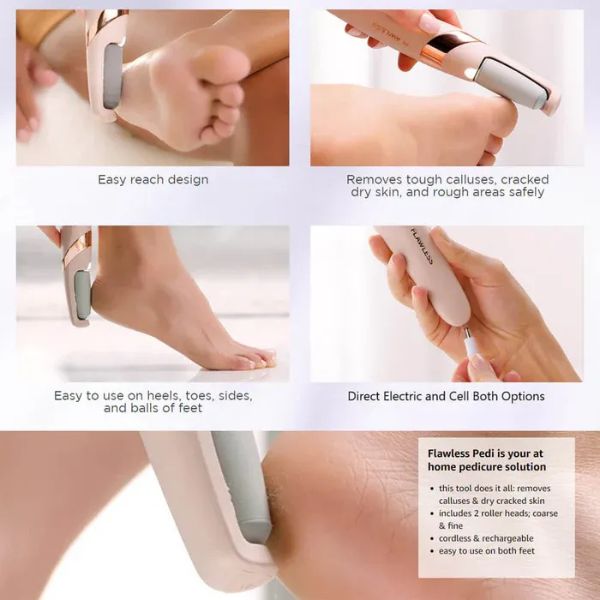 Rechargeable Electric Foot File – Callus Remover & Pedicure Tool for Cracked Heels
